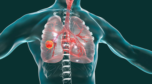 Kaj so prvi znaki raka pljuč?
