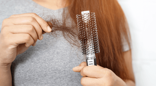 Izpadanje las - alopecija | Najzdravnik