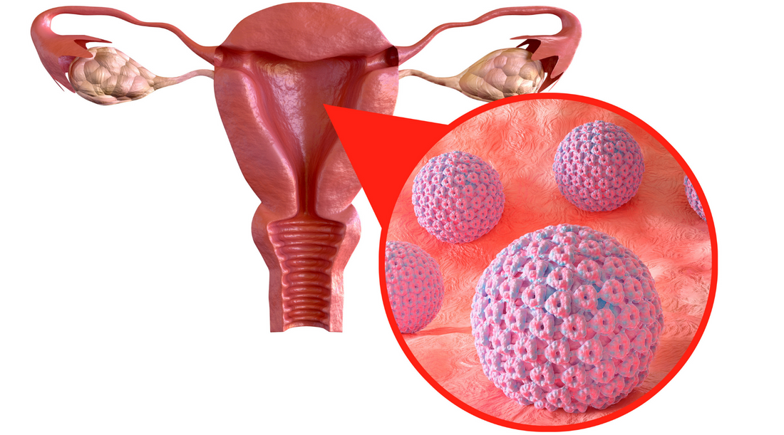 Najpogostejša spolna bolezen - HPV-Najzdravnik