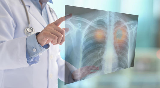 Pljučni rak - Najpogostejši maligni tumor, ki se pojavlja na pljučih-Najzdravnik